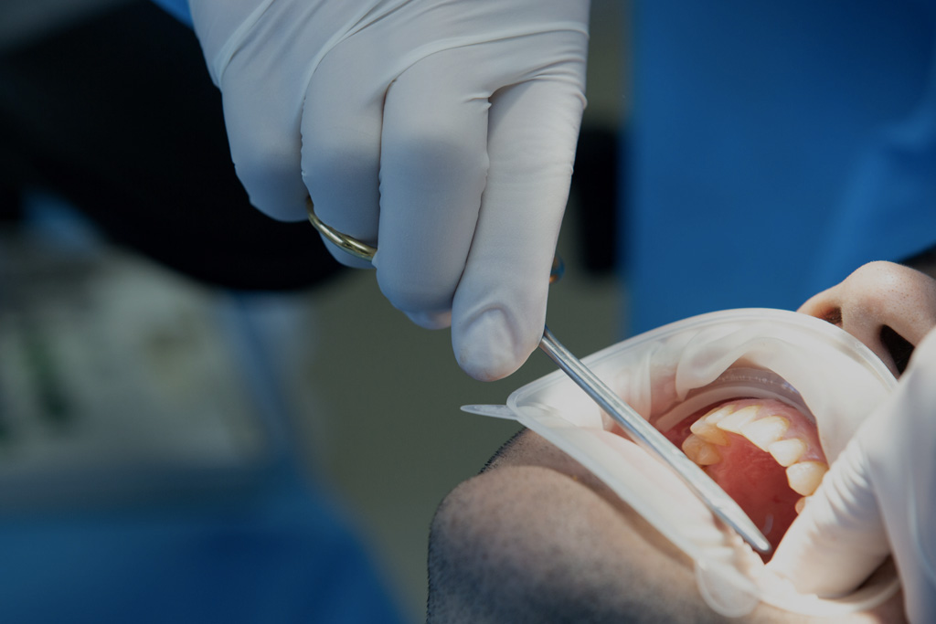 esjident_servicio-cirugia-maxilofacial