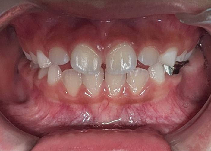 esjident_servicio-odonto-3.png