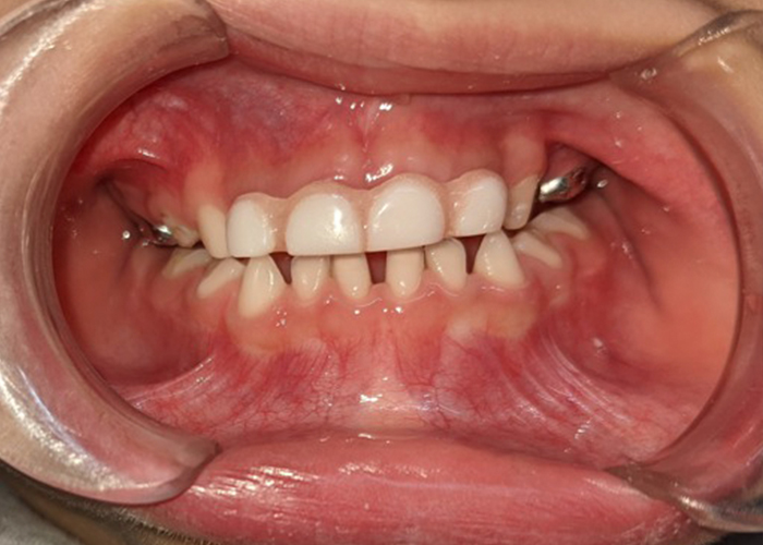 esjident_servicio-odonto-5.png