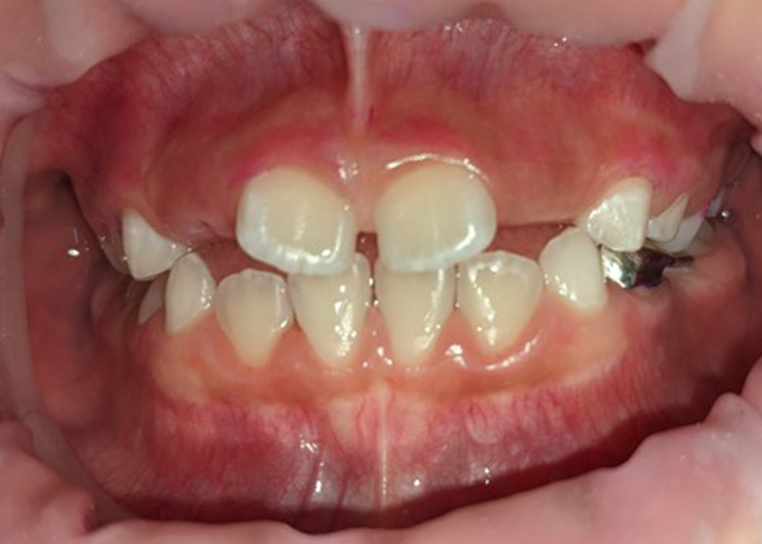 esjident_servicio-odonto42.png