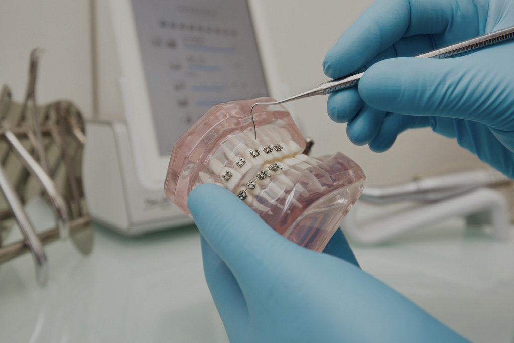 esjident_servicio-ortodoncia