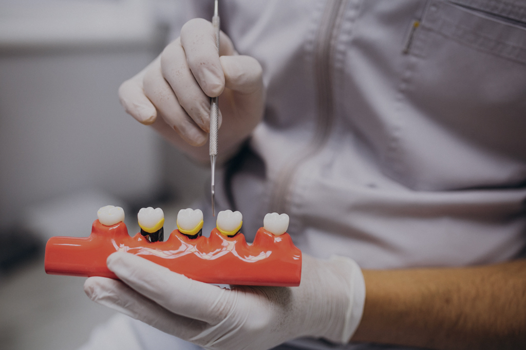 esjident_servicio-periodoncia