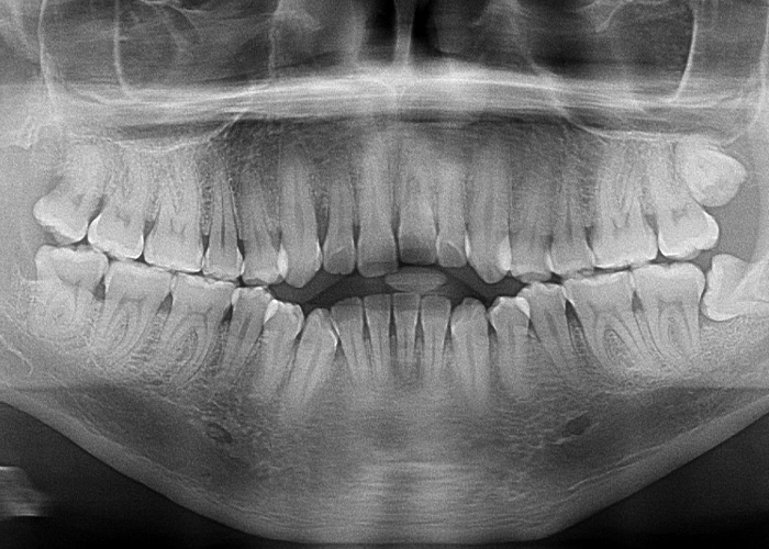 esjident_servicio-real-maxilofacial-2