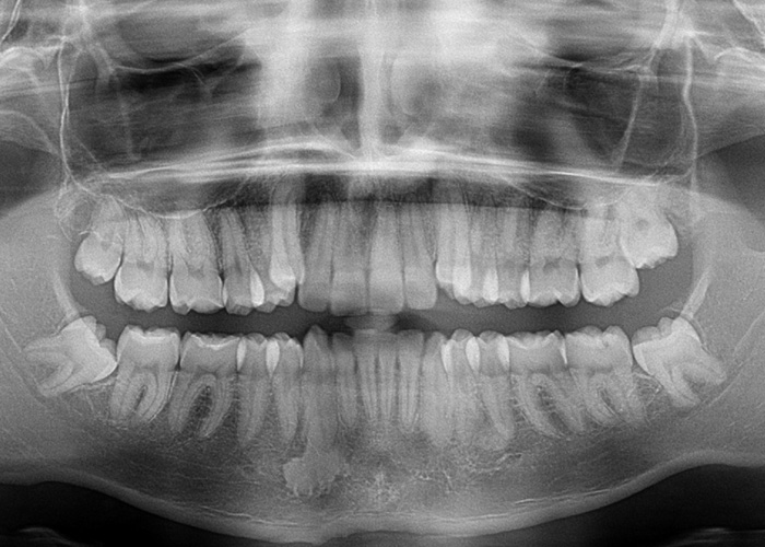 esjident_servicio-real-maxilofacial