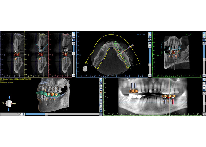 esjident_servicio-real-periodoncia-5